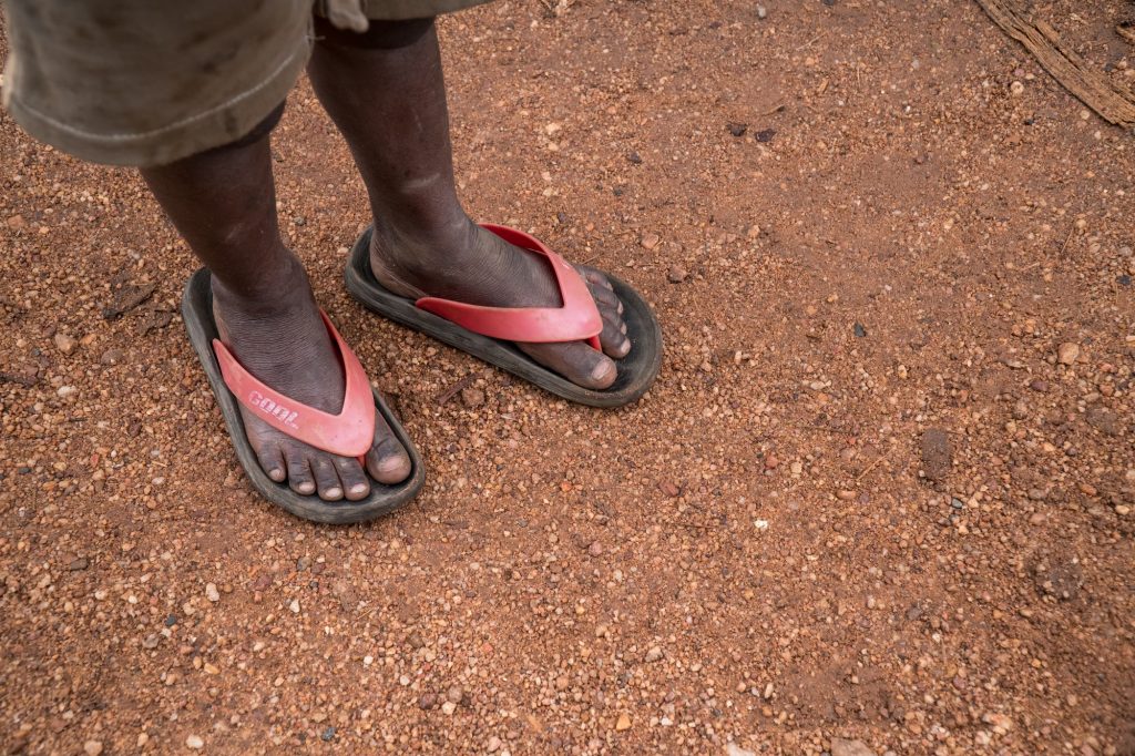Poverty Child Feet in Africa