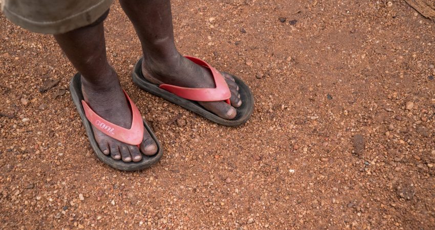Poverty Child Feet in Africa
